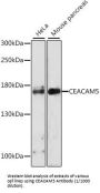 Carcinoembryonic Antigen-Related Cell Adhesion Molecule 5 (CEACAM5) Antibody