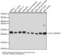 High Sensitive Parkinson Disease Protein 7 (PARK7) Antibody