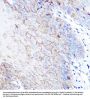 High Sensitive Parkinson Disease Protein 7 (PARK7) Antibody