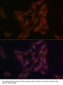 High Sensitive Parkinson Disease Protein 7 (PARK7) Antibody