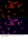 High Sensitive Parkinson Disease Protein 7 (PARK7) Antibody
