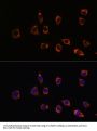 High Sensitive Parkinson Disease Protein 7 (PARK7) Antibody
