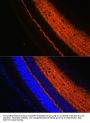 Synaptotagmin 1 (SYT1) Antibody