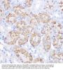 Alpha-1-Antitrypsin (SERPINA1) Antibody