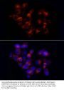 Alpha-1-Antitrypsin (SERPINA1) Antibody