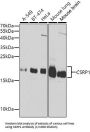 Cysteine And Glycine Rich Protein 1 (CSRP1) Antibody
