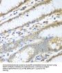 Protein Disulfide Isomerase A3 (PDIA3) Antibody