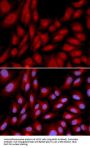 BAG Family Molecular Chaperone Regulator 1 (BAG1) Antibody