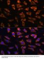 Cysteine Rich Protein, Angiogenic Inducer 61 (CYR61) Antibody