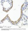 Transthyretin (TTR) Antibody