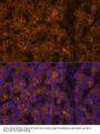 Transthyretin (TTR) Antibody