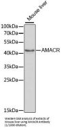 Alpha-Methylacyl-CoA Racemase (AMACR) Antibody