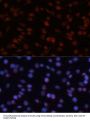 Transcription Factor 4 (TCF4) Antibody