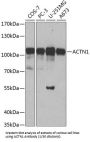 Alpha Actinin 1 (ACTN1) Antibody