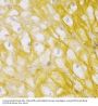 Alpha Actinin 1 (ACTN1) Antibody