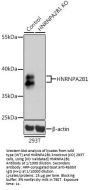 Heterogeneous Nuclear Ribonucleoprotein A2/B1 (HNRNPA2B1) Antibody