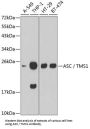 PYD And CARD Domain Containing (PYCARD) Antibody