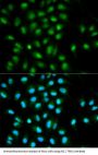 PYD And CARD Domain Containing (PYCARD) Antibody