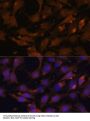 GTPase KRas (KRAS) Antibody