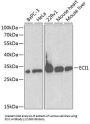 Enoyl-CoA Delta Isomerase 1, Mitochondrial (ECI1) Antibody
