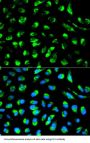 Enoyl-CoA Delta Isomerase 1, Mitochondrial (ECI1) Antibody