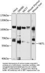 Neuroepithelial Cell Transforming Gene 1 (NET1) Antibody