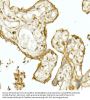 Nuclear Factor, Erythroid Derived 2 Like 2 (NFE2L2) Antibody
