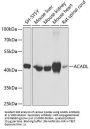 Acyl-CoA Dehydrogenase, Long Chain (ACADL) Antibody