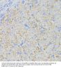 Acyl-CoA Dehydrogenase, Long Chain (ACADL) Antibody