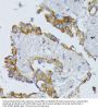 Acyl-CoA Dehydrogenase, Long Chain (ACADL) Antibody