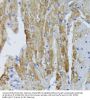 Acyl-CoA Dehydrogenase, Long Chain (ACADL) Antibody