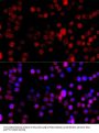 Cytochrome P450 1B1 (CYP1B1) Antibody