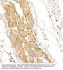 Dystrophin (DMD) Antibody
