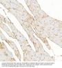 Dystrophin (DMD) Antibody