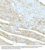 Dystrophin (DMD) Antibody