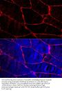 Dystrophin (DMD) Antibody