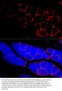 Dystrophin (DMD) Antibody