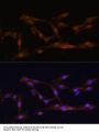 Cystathionine Beta-Synthase (CBS) Antibody
