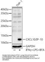 Interferon Gamma Induced Protein 10 kDa / IP-10 (CXCL10) Antibody