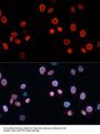 Cyclin Dependent Kinase Inhibitor 1A (CDKN1A) Antibody