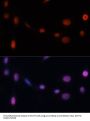 Cyclin Dependent Kinase Inhibitor 1A (CDKN1A) Antibody