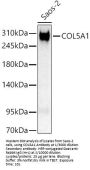 Collagen Type V Alpha 1 (COL5A1) Antibody