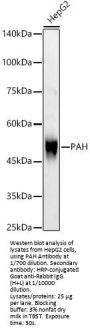 Phenylalanine Hydroxylase (PAH) Antibody
