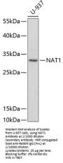 Arylamine N-Acetyltransferase 1 (NAT1) Antibody