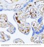 Alpha-2-Macroglobulin (A2M) Antibody