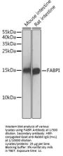 Fatty Acid-Binding Protein, Intestinal (FABP2) Antibody