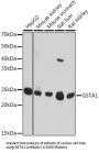 Glutathione S Transferase Alpha 1 (GSTA1) Antibody