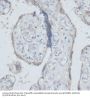 Dystrobrevin Binding Protein 1 (DTNBP1) Antibody
