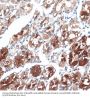 Dystrobrevin Binding Protein 1 (DTNBP1) Antibody