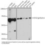 Cytochrome B-245 Heavy Chain (CYBB) Antibody